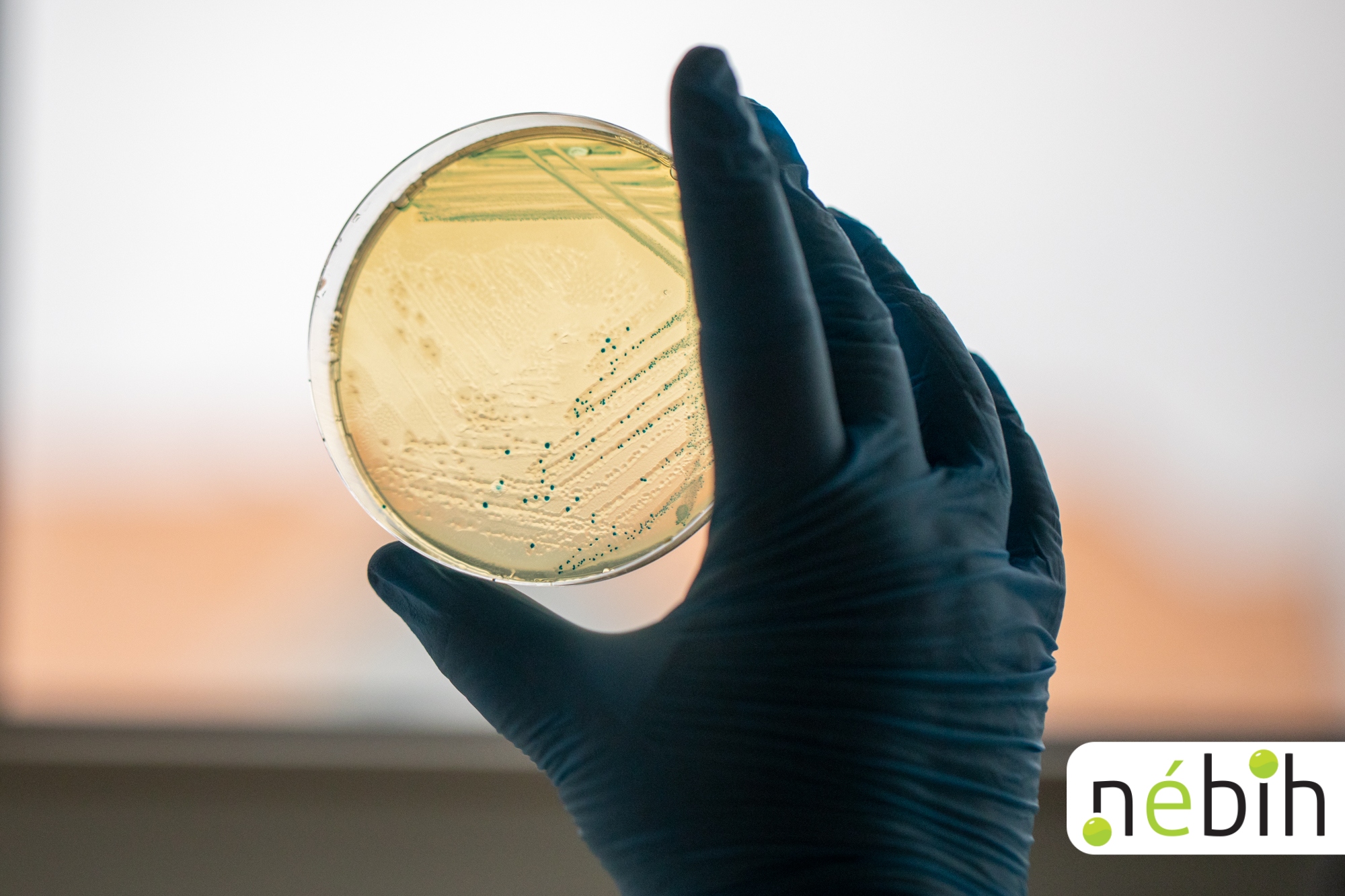 A képen egy fekete gumikesztyűs kéz tart egy petri csészét.